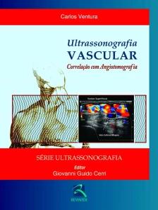 Ultrassonografia Vascular